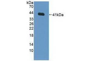 Detection of Recombinant FNTa, Human using Polyclonal Antibody to Farnesyltransferase Alpha (FNTa)