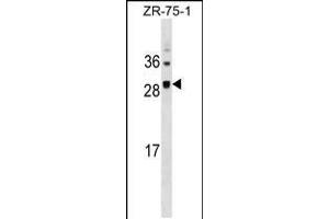 Western blot analysis in ZR-75-1 cell line lysates (35ug/lane). (SPC25 anticorps  (AA 87-114))