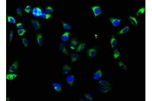 Immunofluorescence staining of Hela cells with ABIN7127584 at 1:61, counter-stained with DAPI.