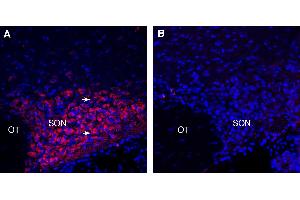 Expression of PMAT in rat supraoptic nucleus (SON).