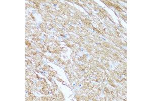 Immunohistochemistry of paraffin-embedded mouse heart using CYCS antibody. (Cytochrome C anticorps  (AA 1-105))
