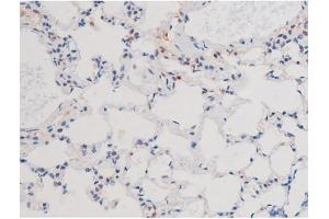 ABIN6267485 at 1/200 staining Rat lung tissue sections by IHC-P.