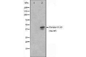 Western blot analysis on Jurkat cell lysate using Phospho-CCR5(Ser349) Antibody. (CCR5 anticorps  (pSer349))