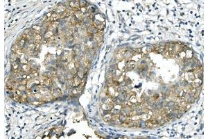 IHC analysis of BubR1/BUB1B using anti-BubR1/BUB1B antibody (ABIN7600960).