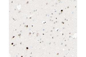 ABIN6267413 at 1/100 staining human brain tissue sections by IHC-P. (CEBPB anticorps  (pThr235))