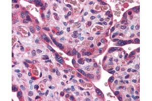 heart, liver, pancreas, brain