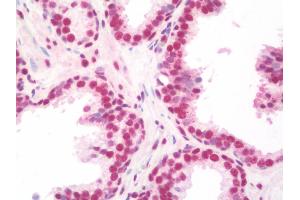 Anti-NELFA / WHSC2 antibody IHC staining of human prostate. (WHSC2 anticorps  (AA 280-511))