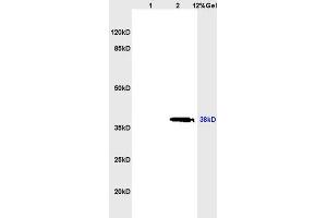 L1 rat heart lysates L2 rat brain lysates probed with Anti L-Selectin/CD62L Polyclonal Antibody, Unconjugated (ABIN736716) at 1:200 overnight at 4 °C.