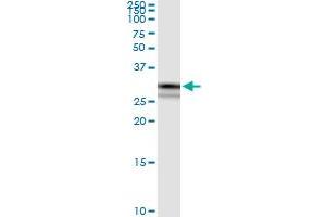 Immunoprecipitation of CRYZ transfected lysate using anti-CRYZ MaxPab rabbit polyclonal antibody and Protein A Magnetic Bead , and immunoblotted with CRYZ purified MaxPab mouse polyclonal antibody (B01P) .