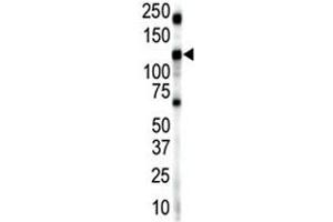 Western blot analysis of Insulin receptor-related antibody and mouse brain lysate.
