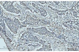 IHC analysis of Cytokeratin 5 using anti-Cytokeratin 5 antibody (ABIN7602992). (Cytokeratin 5 anticorps  (Middle Region))