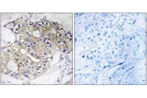 Immunohistochemistry (IHC) image for anti-Dehydrogenase/reductase (SDR Family) Member 4 (DHRS4) (AA 191-240) antibody (ABIN2890257) (DHRS4 anticorps  (AA 191-240))