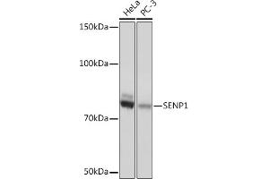 Western blot analysis of extracts of various cell lines, using SENP1 Rabbit mAb (ABIN1680747, ABIN7101692, ABIN7101693 and ABIN7101694) at 1:1000 dilution. (SENP1 anticorps)