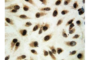 Anti-ERK1 antibody, IHC(P) ICC: HELA Cell