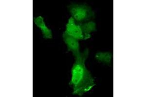 Anti-ANXA11 mouse monoclonal antibody (ABIN2452757) immunofluorescent staining of COS7 cells transiently transfected by pCMV6-ENTRY ANXA11 (RC212191). (Annexin A11 anticorps)