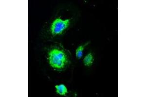 Image no. 17 for anti-Premelanosome Protein (PMEL) antibody (ABIN1500300)