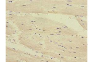 Immunohistochemistry of paraffin-embedded human heart tissue using ABIN7149768 at dilution of 1:100