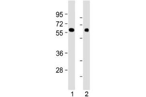 Western blot testing of human 1) kidney and 2) lung tissue lysate with MKS1 antibody at 1:2000. (MKS1 anticorps  (N-Term))