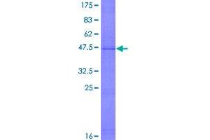 Image no. 1 for Cyclin E1 (CCNE1) (AA 1-410) protein (GST tag) (ABIN1348459)