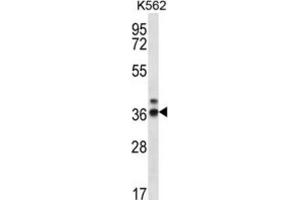Western Blotting (WB) image for anti-Ribonuclease P/MRP 38kDa Subunit (RPP38) antibody (ABIN2996921) (RPP38 anticorps)