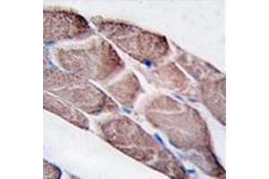 Image no. 2 for anti-Epilepsy, Progressive Myoclonus Type 2A, Lafora Disease (Laforin) (EPM2A) (C-Term) antibody (ABIN356954) (EPM2A anticorps  (C-Term))