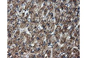 Immunohistochemical staining of paraffin-embedded liver tissue using anti-ATP5Bmouse monoclonal antibody.