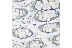 Immunohistochemistry of paraffin-embedded human colon using TNNC2 antibody at dilution of 1:200 (40x lens). (TNNC2 anticorps)