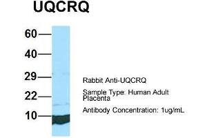Host: Rabbit  Target Name: UQCRQ  Sample Tissue: Human Adult Placenta  Antibody Dilution: 1. (UQCRQ anticorps  (Middle Region))