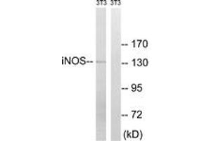 Western blot analysis of extracts from NIH-3T3 cells, using iNOS (Ab-151) Antibody. (NOS2 anticorps  (AA 117-166))