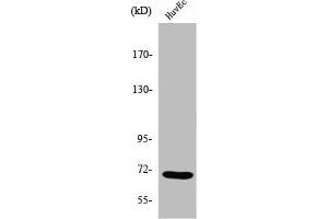 Western Blot analysis of COLO205 cells using Sam 68 Polyclonal Antibody (KHDRBS1 anticorps  (Internal Region))