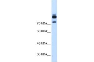 Western Blotting (WB) image for anti-Myotubularin Related Protein 1 (MTMR1) antibody (ABIN2462536) (MTMR1 anticorps)