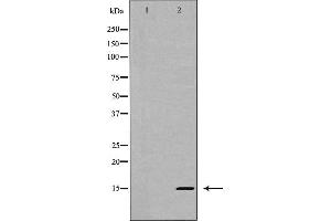 Western blot analysis of Interleukin 5 expression in HT-29 cells,The lane on the left is treated with the antigen-specific peptide. (IL-5 anticorps  (Internal Region))