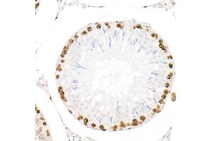 Immunohistochemistry of paraffin-embedded rat testis using PCNA antibody (ABIN6133630, ABIN6139020, ABIN6139022 and ABIN7101400) at dilution of 1:2700 (40x lens). (PCNA anticorps)
