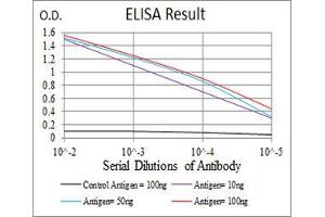 Black line: Control Antigen (100 ng), Purple line: Antigen(10 ng), Blue line: Antigen (50 ng), Red line: Antigen (100 ng), (ATG5 anticorps)