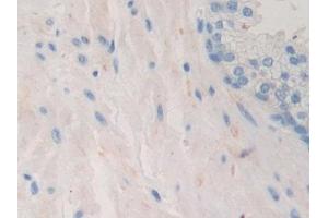 Detection of PDHX in Human Prostate Tissue using Polyclonal Antibody to Pyruvate Dehydrogenase Complex Component X (PDHX) (PDHX anticorps  (AA 220-468))