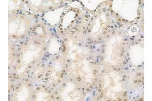 ABIN6258035 and ABIN6275789 at 1/100 staining human normal kidney tissue by IHC-P. (CSRNP2 anticorps  (Internal Region))