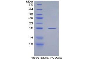 SDS-PAGE analysis of Human Keratin 19 Protein.