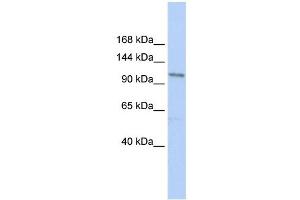 TRPC3 antibody used at 1 ug/ml to detect target protein. (TRPC3 anticorps  (N-Term))