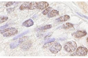 Immunohistochemistry (IHC) image for anti-Ataxia Telangiectasia Mutated (ATM) (AA 2550-2600) antibody (ABIN7448423) (ATM anticorps  (AA 2550-2600))