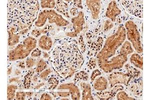 IHC testing of FFPE human kidney tissue with Arginase 1 antibody. (Liver Arginase anticorps)