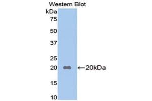 Western Blotting (WB) image for anti-Apolipoprotein B (APOB) (AA 3360-3526) antibody (ABIN1077819) (APOB anticorps  (AA 3360-3526))
