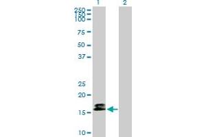 Western Blot analysis of CALM3 expression in transfected 293T cell line by CALM3 MaxPab polyclonal antibody.