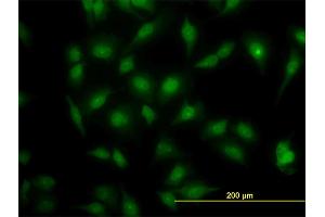 Immunofluorescence of monoclonal antibody to MAPK3 on HeLa cell. (ERK1 anticorps  (AA 279-379))