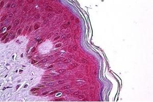 Human Skin: Formalin-Fixed, Paraffin-Embedded (FFPE) (TRIM29 anticorps  (AA 295-306))
