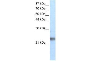 WB Suggested Anti-ZNF313 Antibody Titration: 1. (RNF114 anticorps  (N-Term))