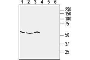 Western blot analysis of human SH-SY5Y neuroblastoma (lanes 1 and 4), human HT-29 colon adenocarcinoma (lanes 2 and 5) and human MCF-7 breast adenocarcinoma (lanes 3 and 6) cell line lysates: - 1-3. (NETO2 anticorps  (Extracellular, N-Term))
