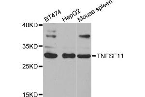 Western blot analysis of extracts of various cell lines, using TNFSF11 antibody (ABIN5971376) at 1/1000 dilution. (RANKL anticorps)