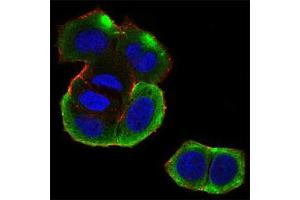 Fig. (CSNK2B anticorps  (AA 1-215))