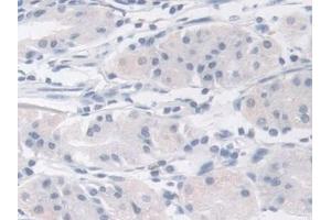 Detection of MPI in Human Stomach Tissue using Polyclonal Antibody to Mannose Phosphate Isomerase (MPI)