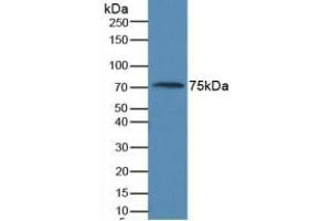 Western blot analysis of Human Serum.